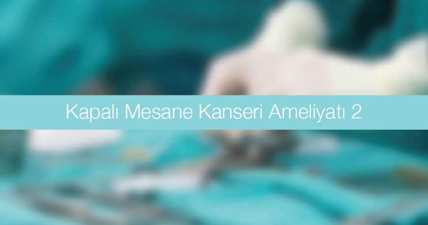 Kapalı Mesane Kanseri Ameliyatı 2 - TUR MT 2