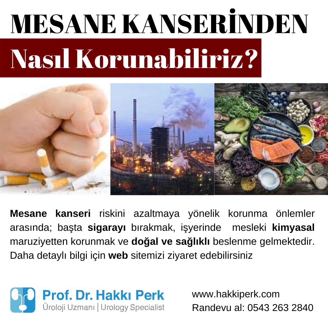 Mesane Kanseri Önlenebilir mi?