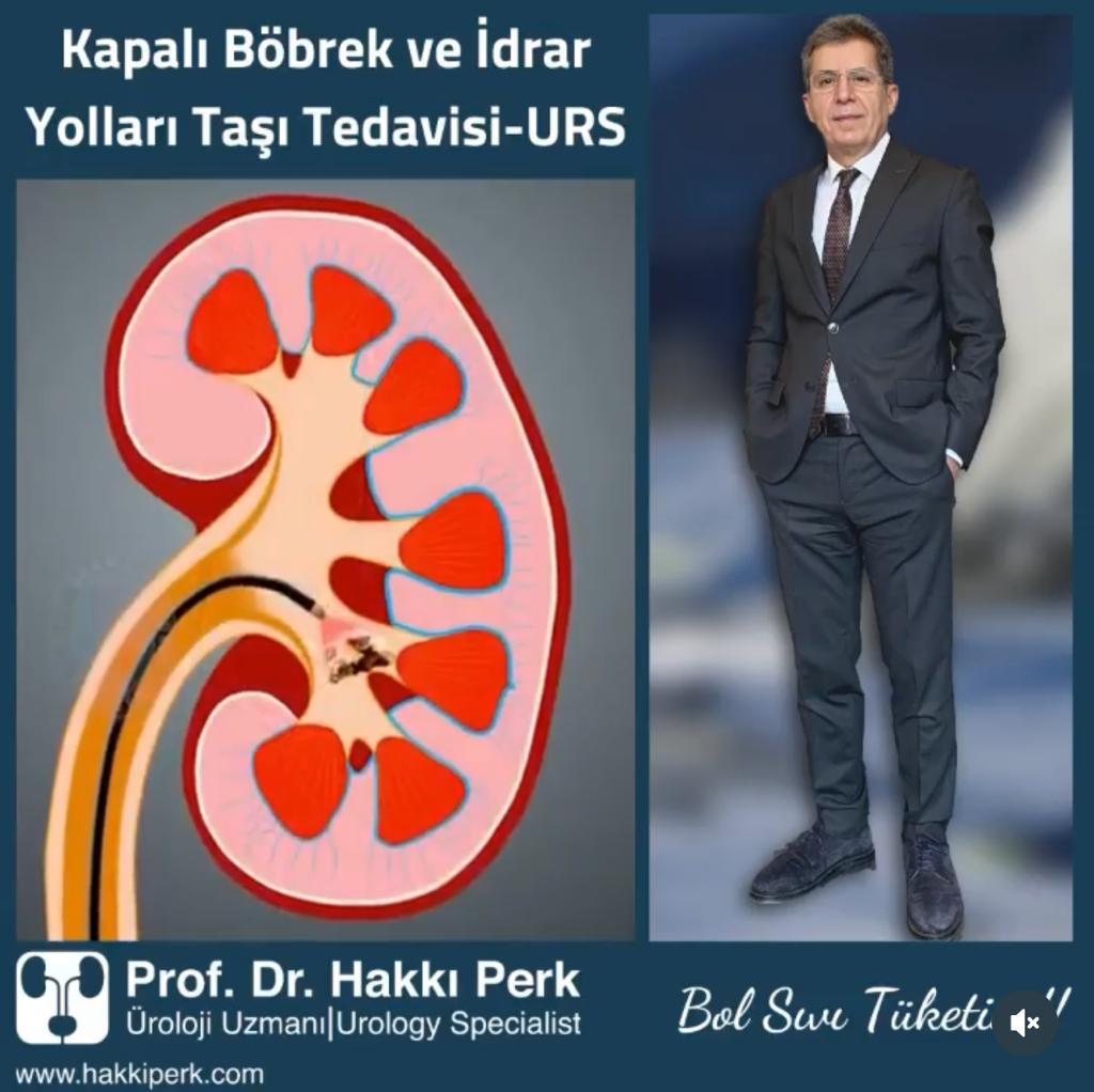 Lazerle Böbrek Taşı Ameliyatı